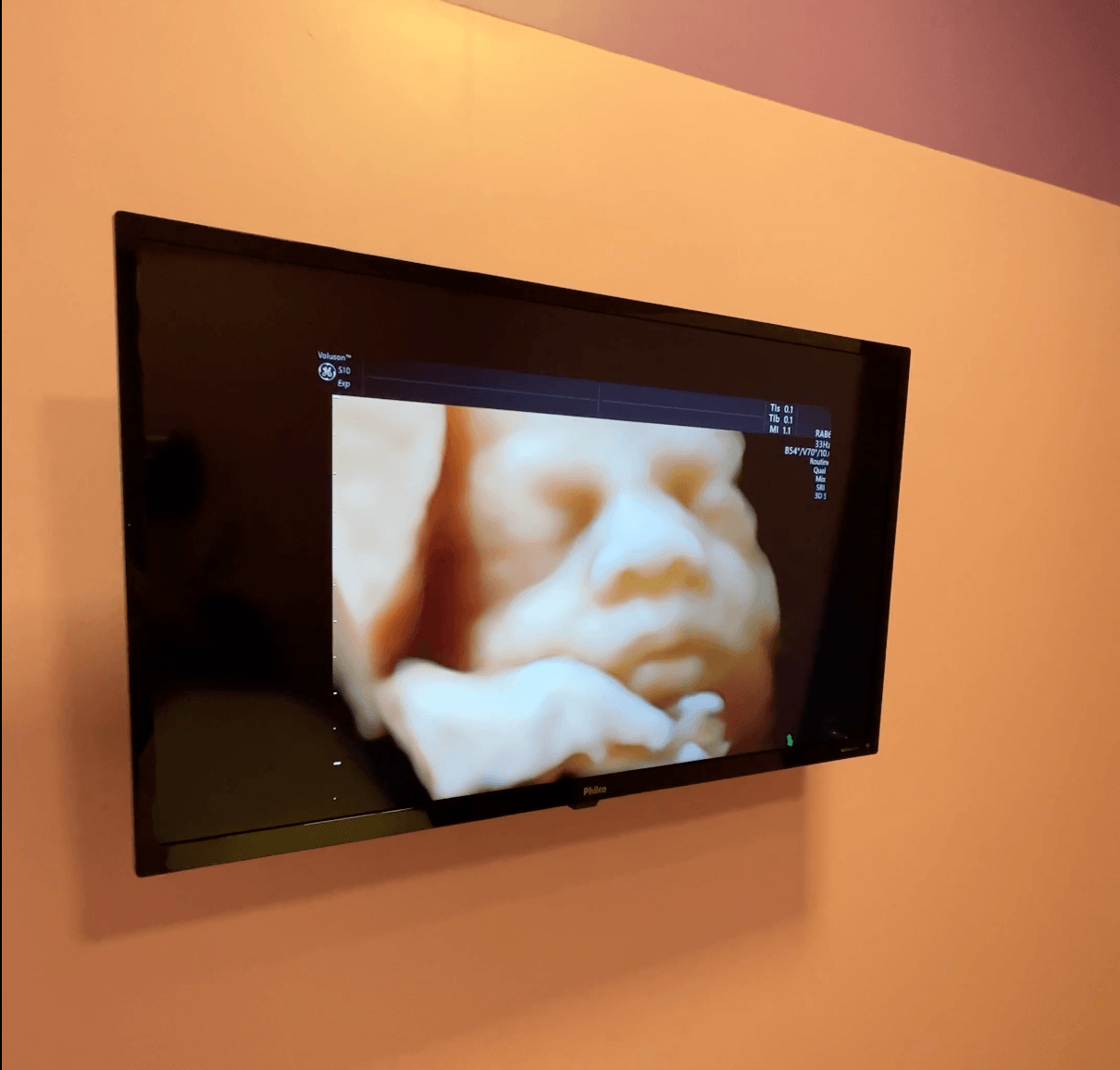 Acompanhamento especializado em medicina fetal