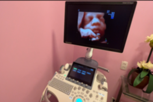 aparelho de ressonancia